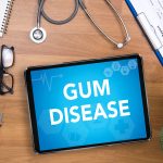 How to Cure Gum Disease Without a Dentist: Effective Home Remedies Revealed