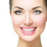 How to Whiten My Teeth with Braces: Achieving a Brighter Smile Safely