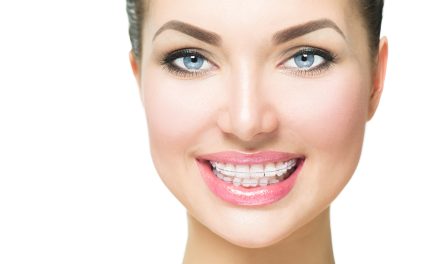 How to Whiten My Teeth with Braces: Achieving a Brighter Smile Safely