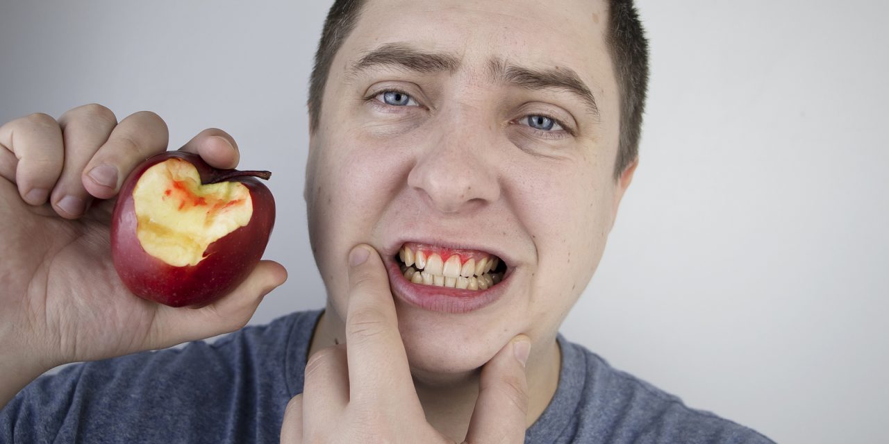 How to Heal Gum Disease: Effective Strategies for Recovery