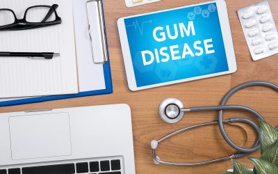 How to Cure Gum Infections: Effective Home Remedies and Medical Treatments