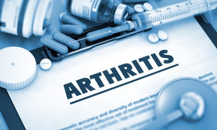 What Supplements Are Good for Arthritis: Top Evidence-Based Picks