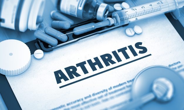 What Supplements Are Good for Arthritis: Top Evidence-Based Picks