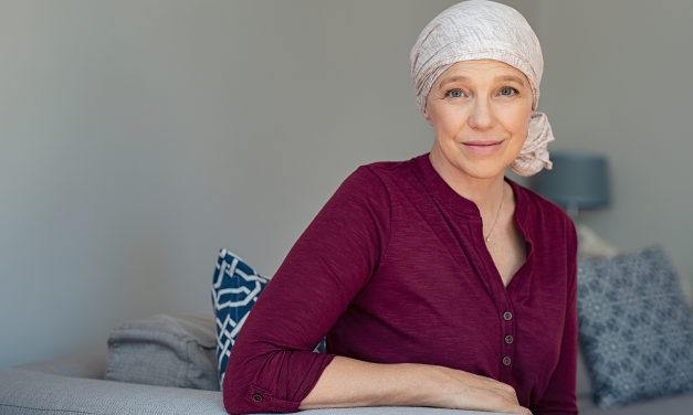 How to Treat Hair Loss After Chemotherapy: Expert Tips and Solutions
