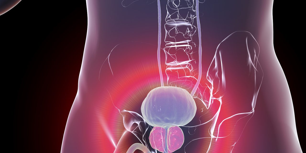 Why Does a Prostate Enlarge and How to Treat It: Understanding BPH Management