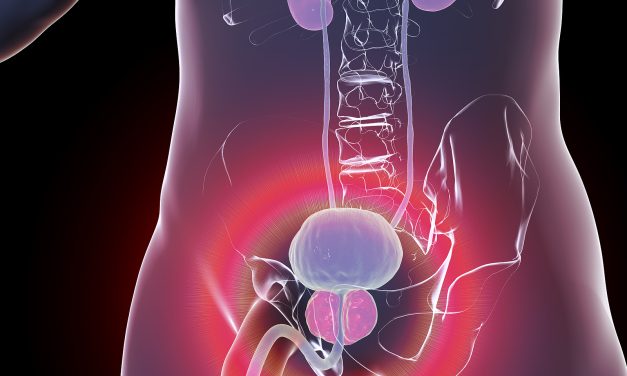 Why Does a Prostate Enlarge and How to Treat It: Understanding BPH Management