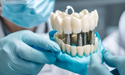 How Much Dental Crown Cost: A Comprehensive Price Guide