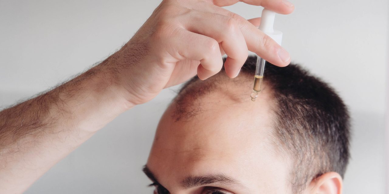 Can Hair Loss Be Reversed: Understanding Treatment Options