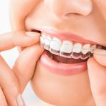 How Dental Braces Work: Understanding Their Function and Benefits