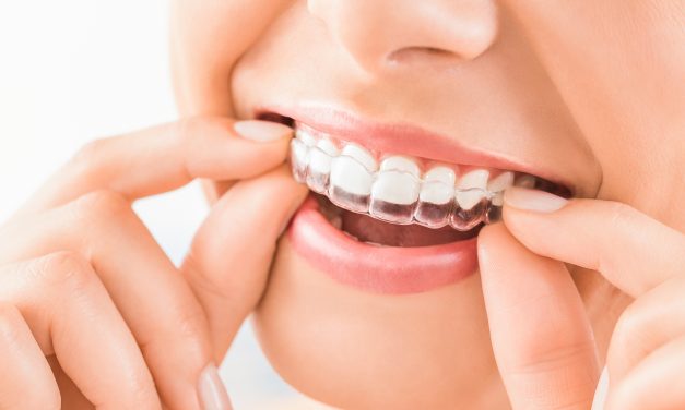 How Dental Braces Work: Understanding Their Function and Benefits