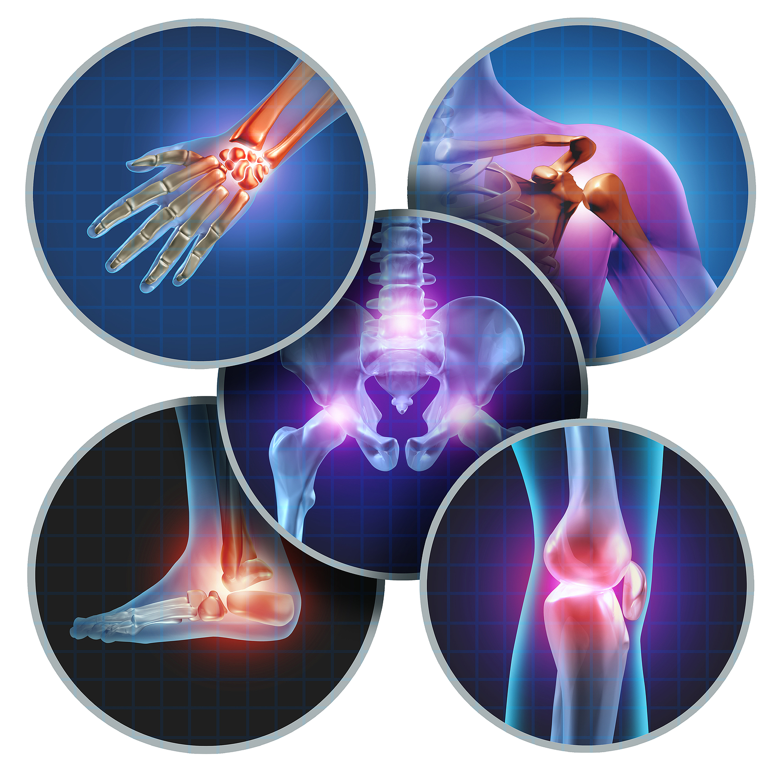 Human painful joints