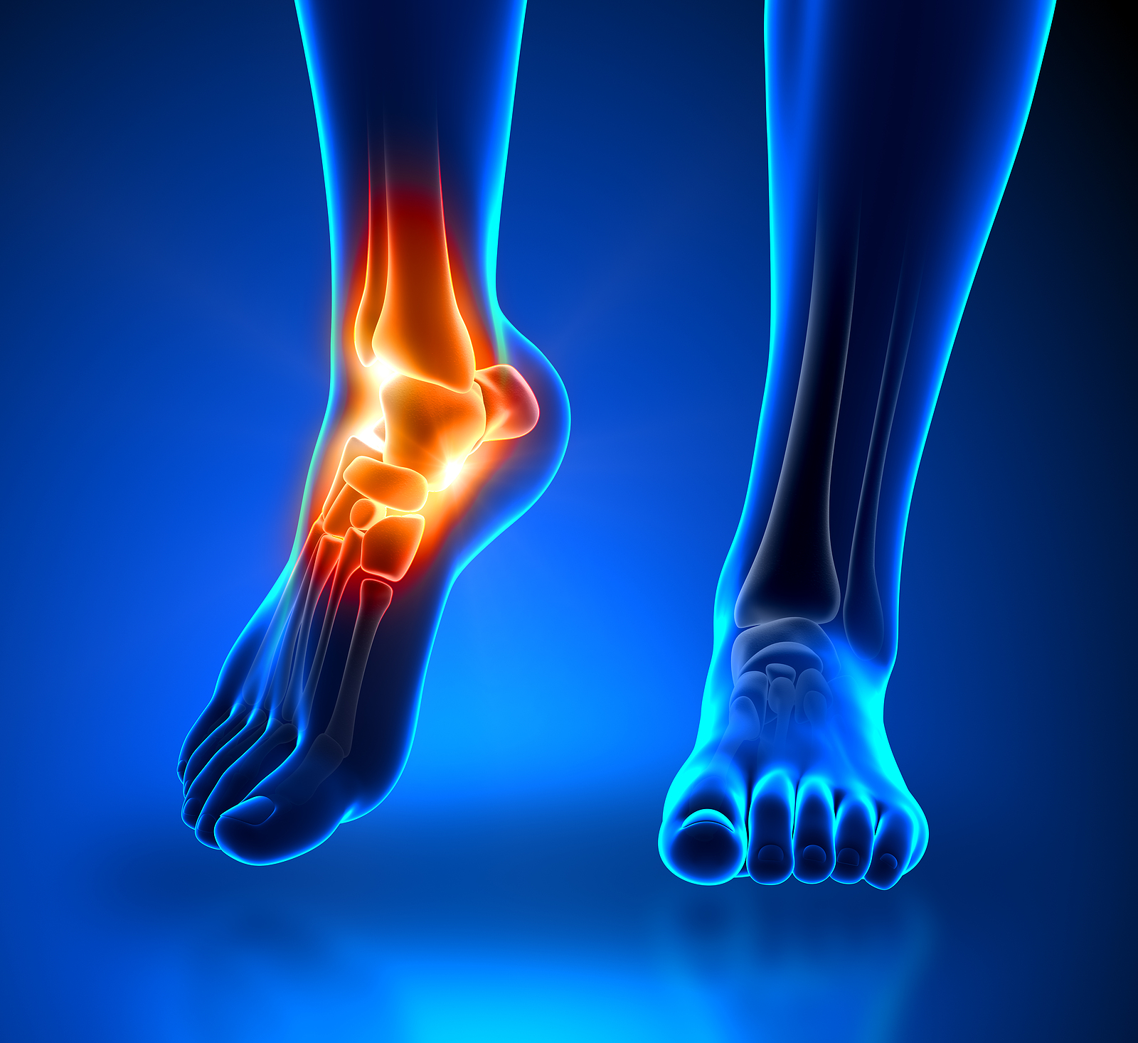 Pain in Ankle Joint