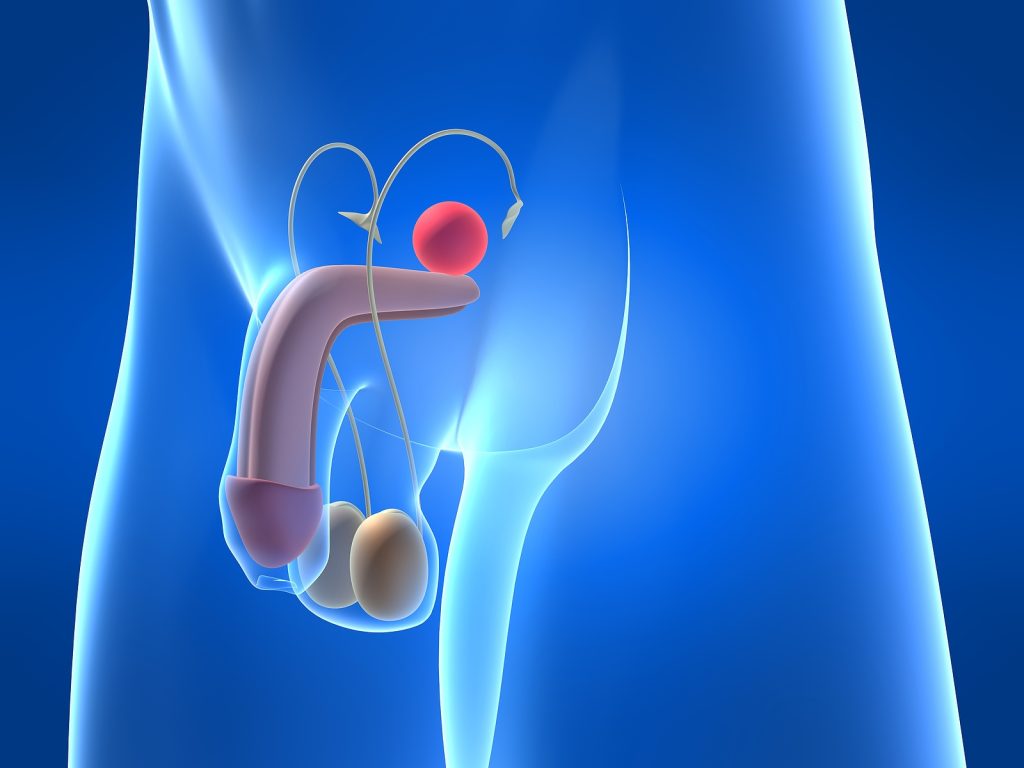 Prostate Enlargement